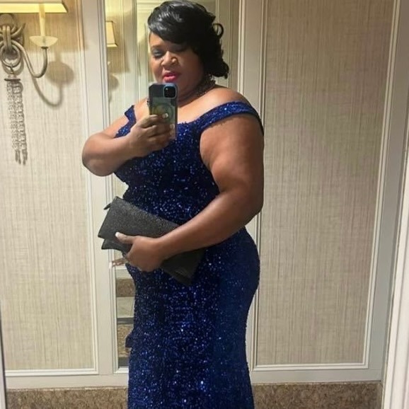 Patient before bariatric surgery