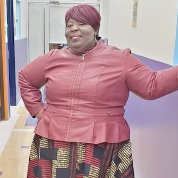 Candis before bariatric surgery